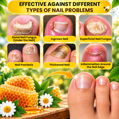 ApiFix | Clearer, Healthier-Looking Nails