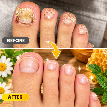 ApiFix | Clearer, Healthier-Looking Nails