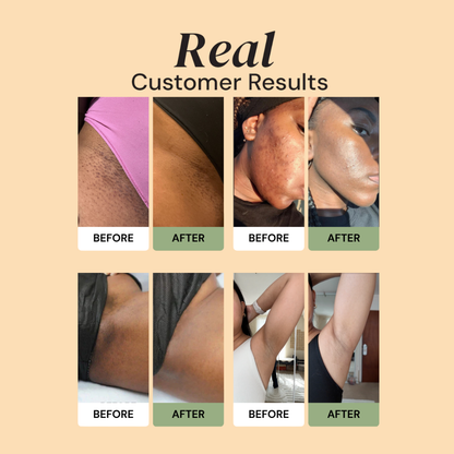 Turmeric & Kojic Acid Radiance Bar