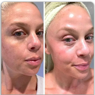 VenoLifta Firming Anti-Ageing Roll-On Serum | Visibly Reduces Wrinkles in Just 17 Minutes
