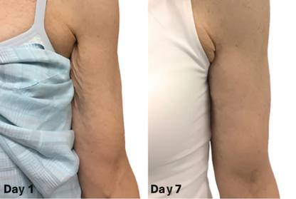 Sadora Firming Cream | Firms, lifts, and restores sagging skin by up to 98% within 24 hours!